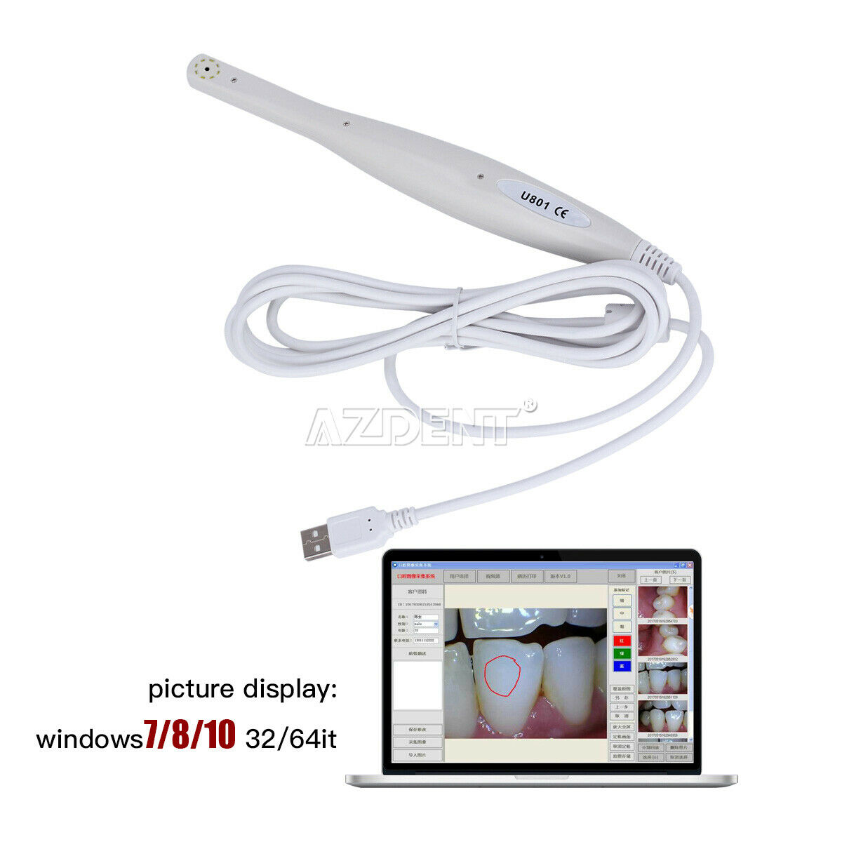 Professional USB Dental 6 LED Intraoral Camera work with 64 bit windows 7/8/10